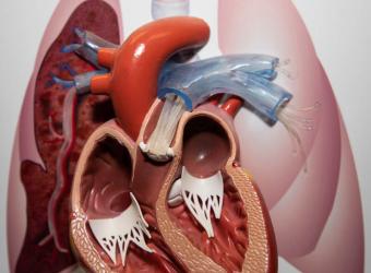 Heartworm Disease